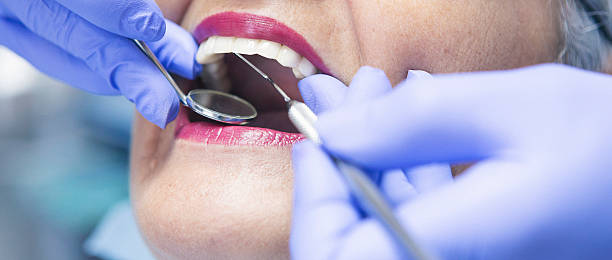 Best Emergency Wisdom Teeth Removal in Lena, IL
